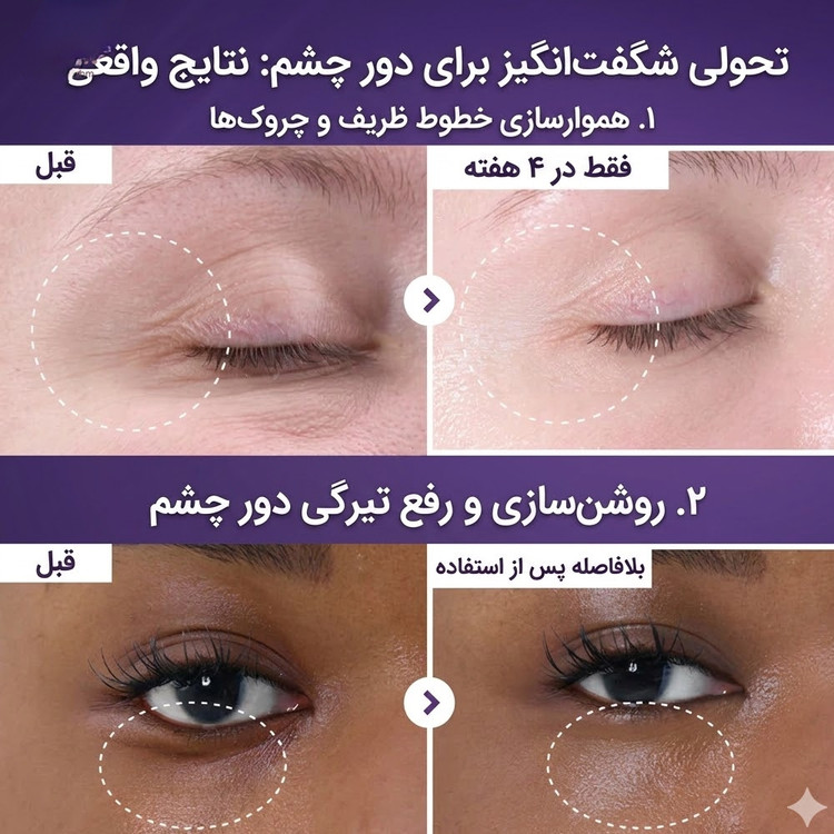 دور چشم 20 میل نامبوزین حاوی nad+ رتینال و پنجاه نوع پپتاید ضد چروک / Numbuzin